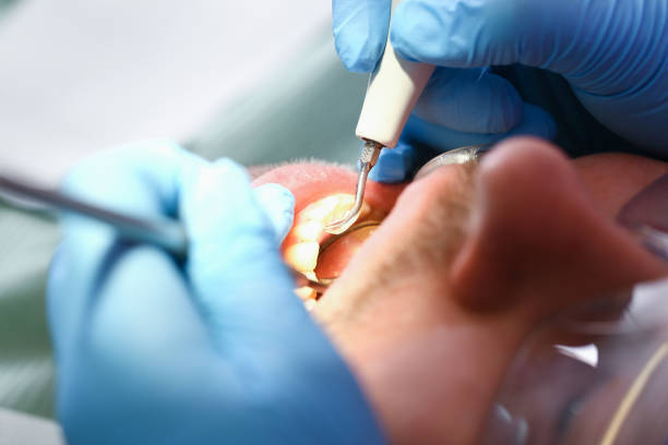 Best Weekend Emergency Dentist in Archer City, TX