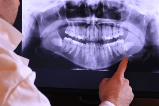Best 24-Hour Emergency Dentist in Archer City, TX