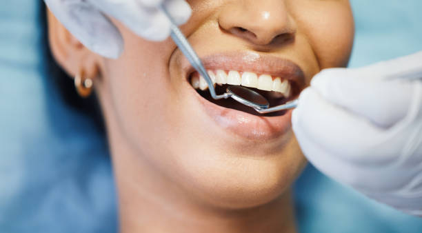 Best Emergency Dental Care for Broken or Chipped Teeth in Archer City, TX