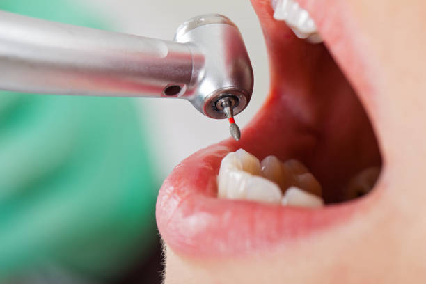 Best Emergency Treatment for Dental Infections or Abscesses in Archer City, TX